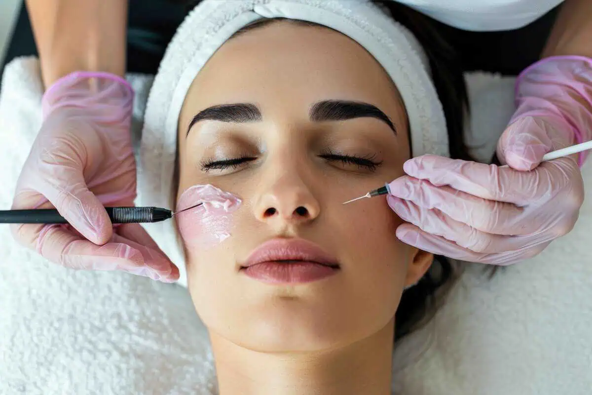 chemical peel at Infused Medspa