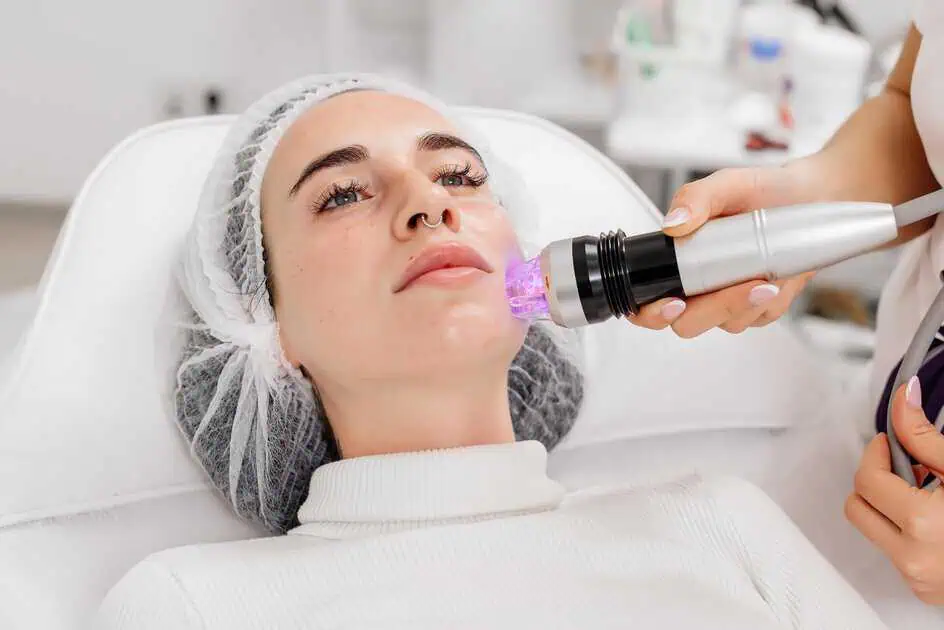 Skin Rejuvenation with RF Microneedling in Horseshoe Bay, TX by Infused Medspa + IV
