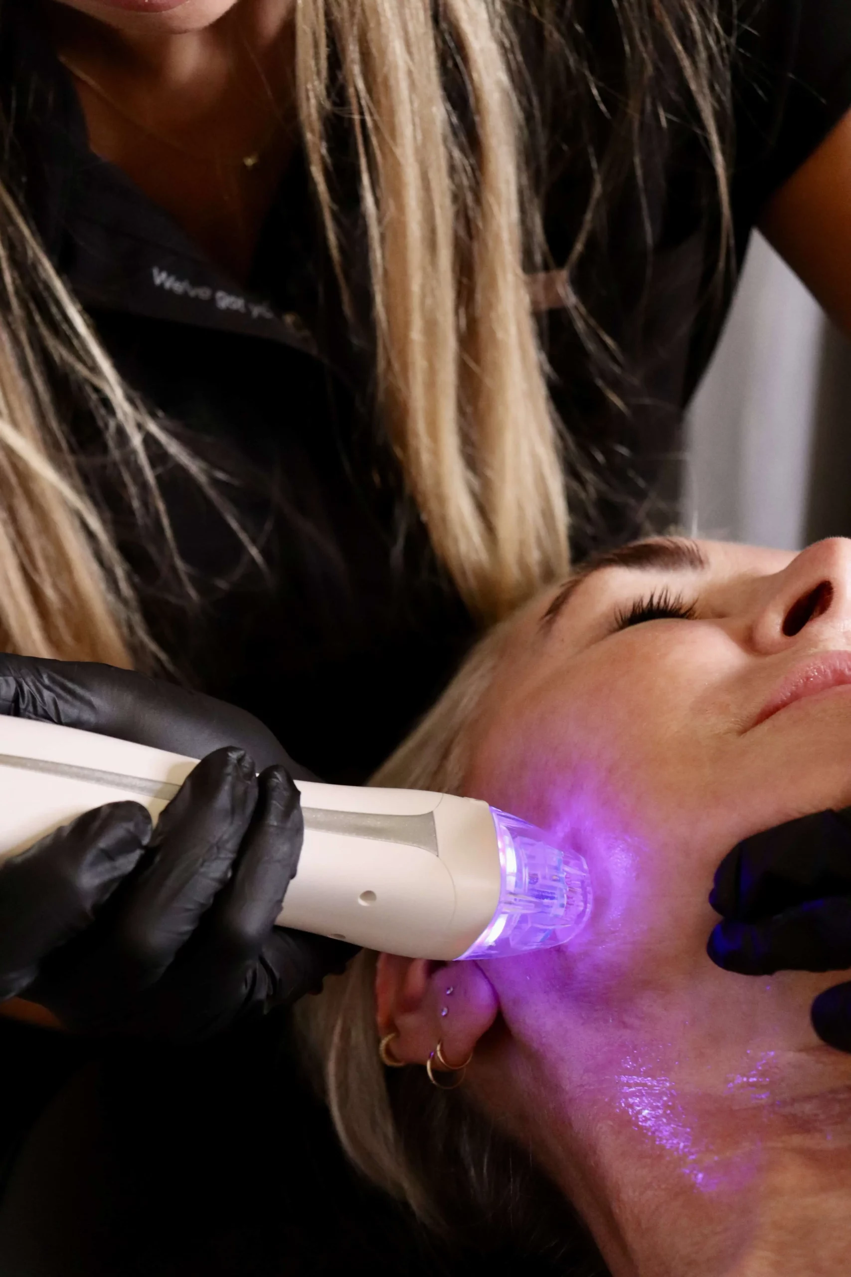 Skin Rejuvenation Treatment at Infused Medspa